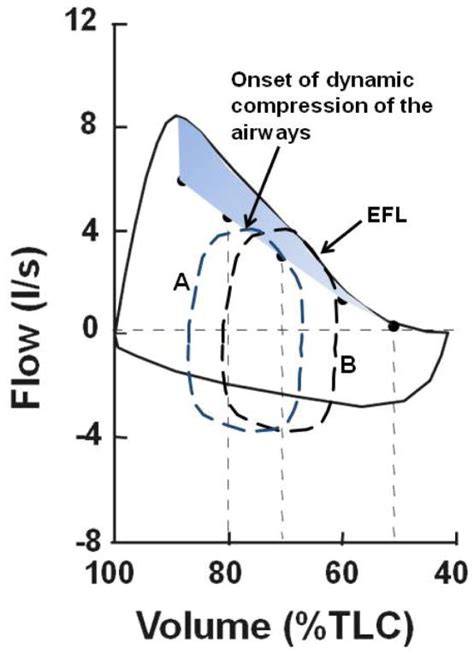 compressione-addome-flow-limitation