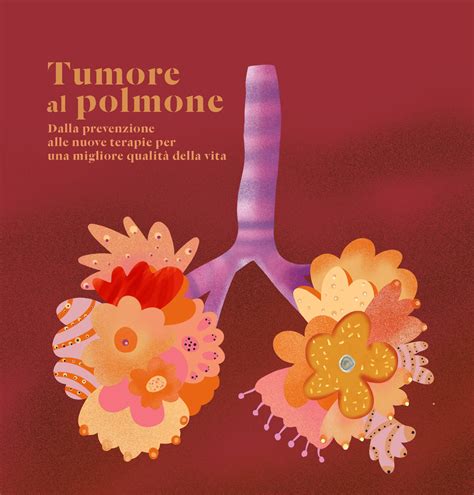 supporto psiconcologico pazienti tumore polmone