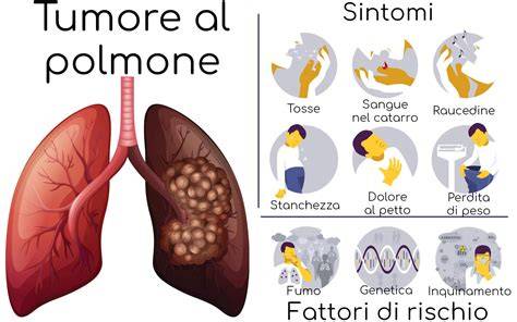 informazioni diagnosi tumore polmone medico-paziente