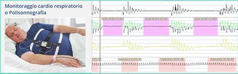 Polisonnografia e CPAP monitoraggio immagine