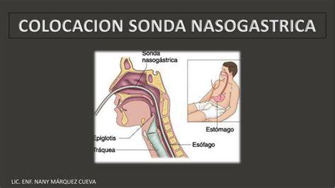 Immagine anatomia naso-gastrica e percorso SNG