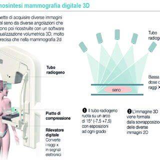 Rappresentazione radiografica del posizionamento SNG
