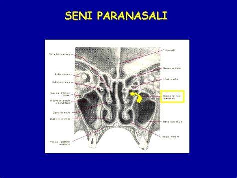 grafico anatomia seni paranasali