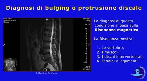 immagine risonanza e localizzazione protrusione
