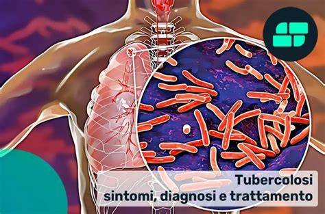 grafico differenze tubercolosi ossea vs polmonare