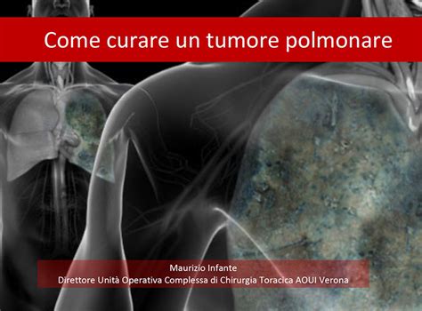 domande comuni arsenico tumore polmonare