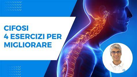 Schema esercizi per la cifosi e miglior postura