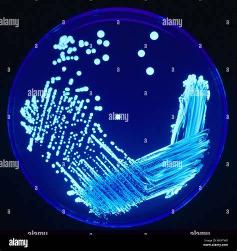 Immagine di colonie di Legionella a vetro smerigliato