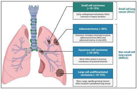 diagramma biomarker polmone NSCLC