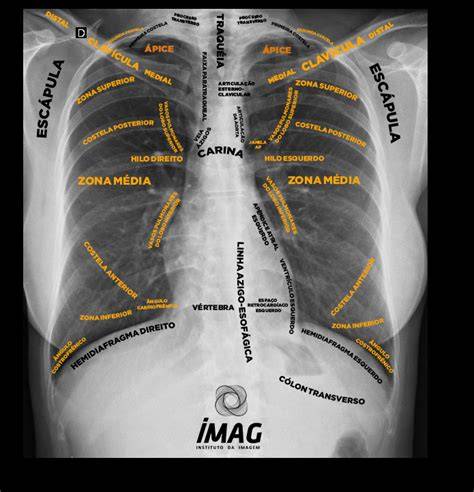torace radiologia: angolo di Torax