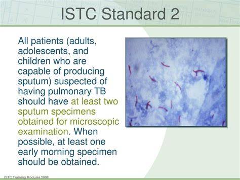 ISTC universal standard tuberculosis care