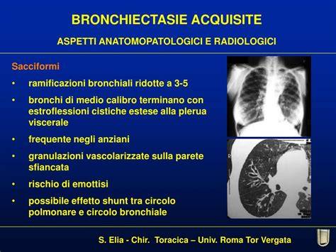 Bronchiectasie: profili cilindriche e cistiche