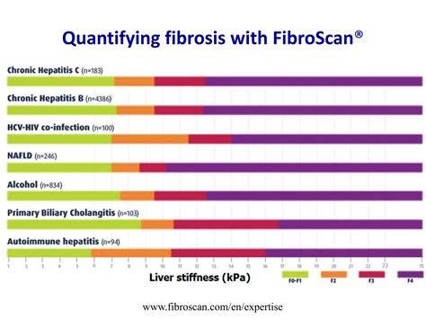 fibrosis assessment with FibroScan infographic