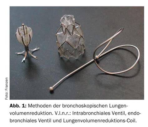 valvole endobronchiali e riduzione volume polmonare