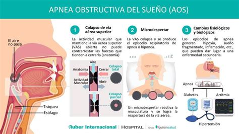 fisiologia apnea medicina emergenze