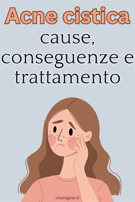 Diagramma flusso trattamento acne cistica